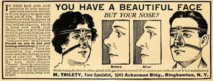 1920 Ad M. Trilety Face Specialist Correct Nose Brace - ORIGINAL ILW1